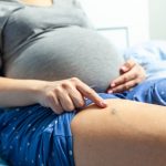 Mang thai nổi gân xanh ở chân: mẹ bầu cần làm gì để phòng ngừa và giảm triệu chứng?